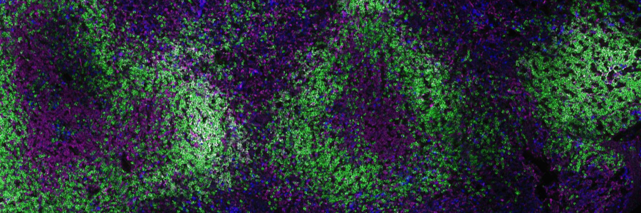 Babraham Institute research shows importance of second COVID-19 vaccine dose, reports Cambridge Independent