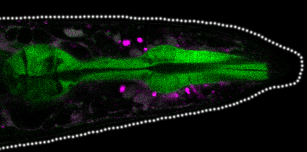 Extracellular aggregates