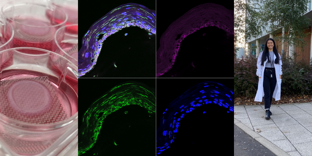 Learning to grow human skin in a petri dish