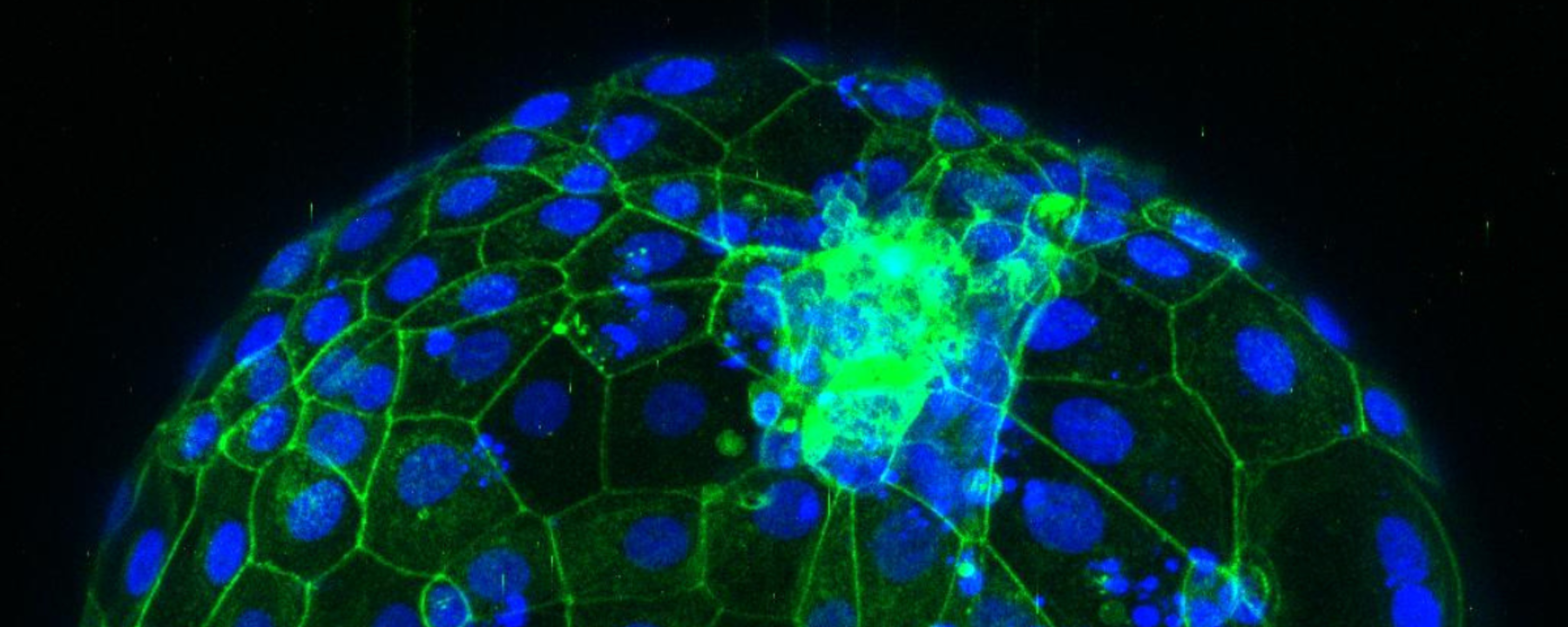 Top section of a microscopy image of a human embryo 7 days after fertilisation. Nuclei are shown in blue, and the shape of each cell is outlined in green.