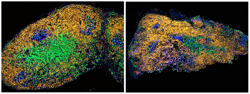 Poor germinal centre responses in aged mice after immunisation