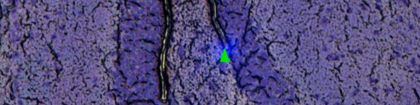 Laser Micro-dissection/Laser Capture