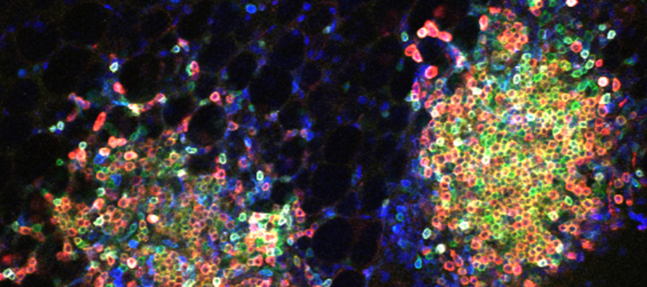 Lymphocyte Signalling