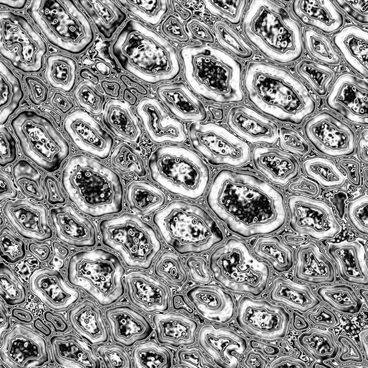 Nerve cross section