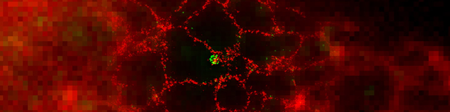 Super Resolution Imaging