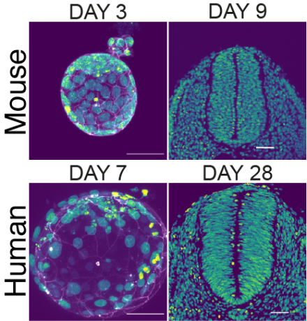 Mouse and human embryos at same point of development