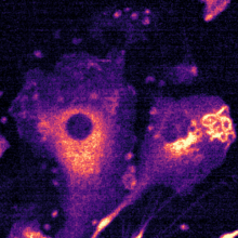 A false-coloured image of phagocytic primary macrophages expressing a fluorescent reporter to detect cellular hydrogen peroxide production. Image credit: Oisharja Rahman